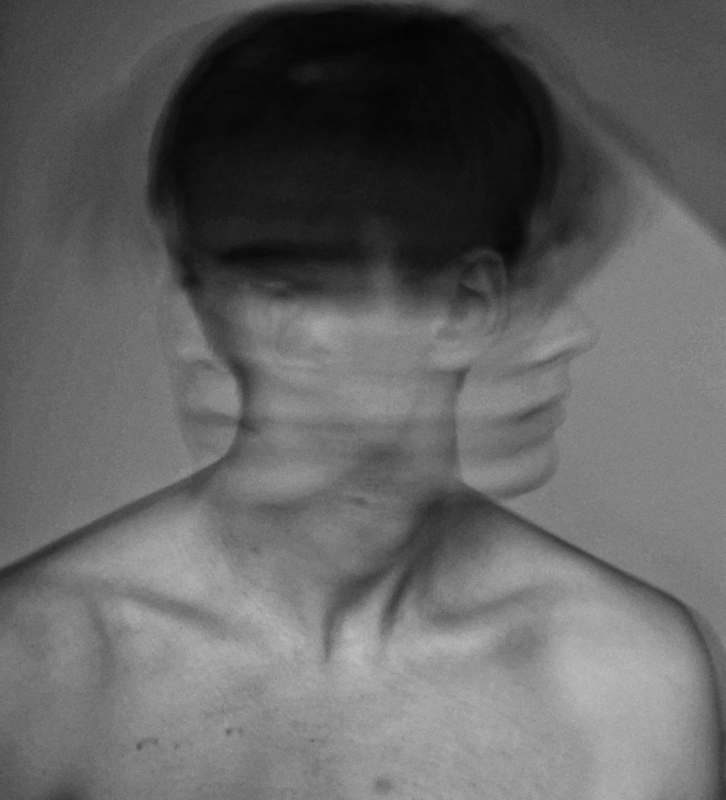 Dissociative Disorders