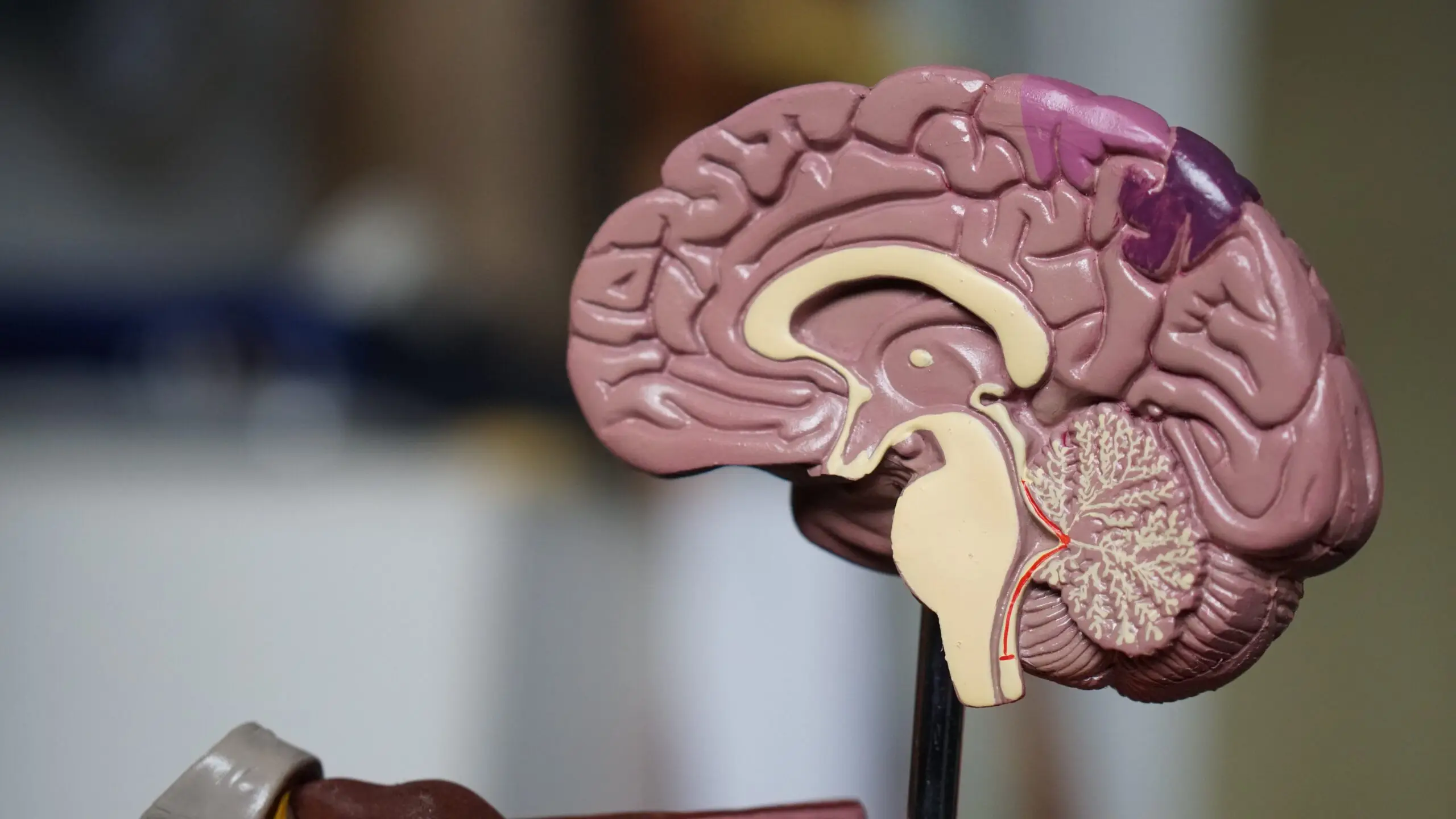 model of brain | schizoaffective disorder